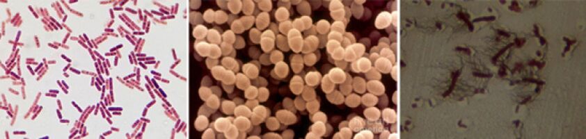E. coli, enterococo fecal e proteus son os principais axentes causantes da prostatite bacteriana crónica