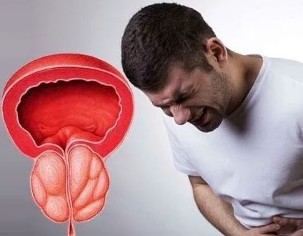Os síntomas de enfermidades crónicas prostatite en homes