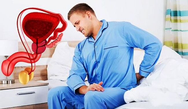 dor lumbar debido á prostatite